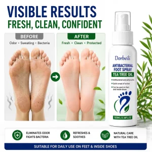 Custom OEM Foot Antiperspirant Spray Natural Herbal Antibacterial Odor Control Foot Spray Private Label Factory Direct Price